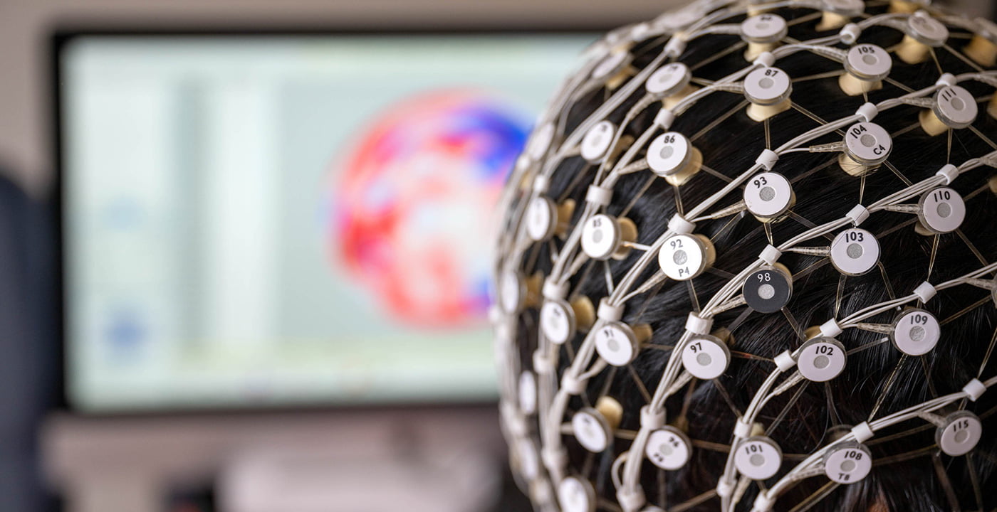 transcranial photobiomodulation light therapy