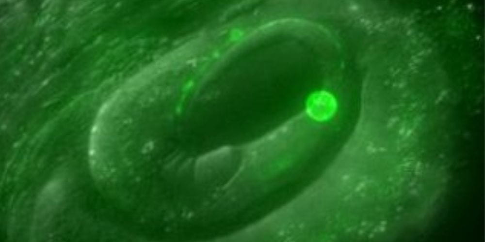worm embryo