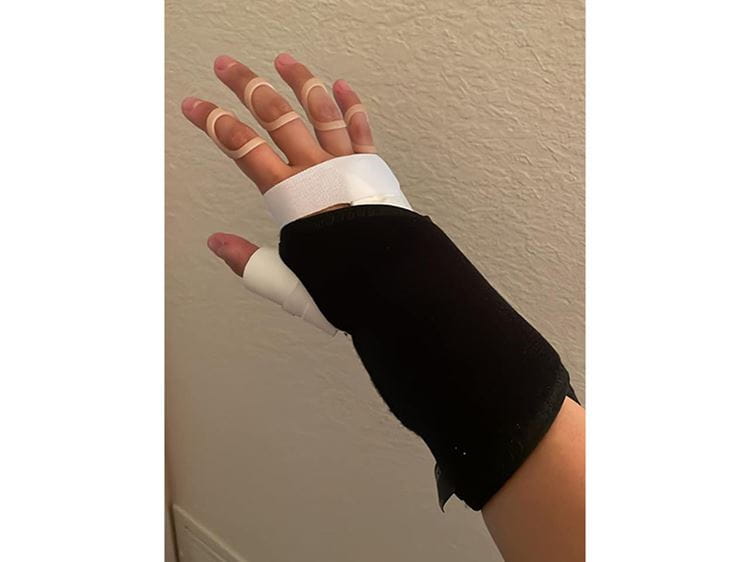 Picture of a person wrist in a brace